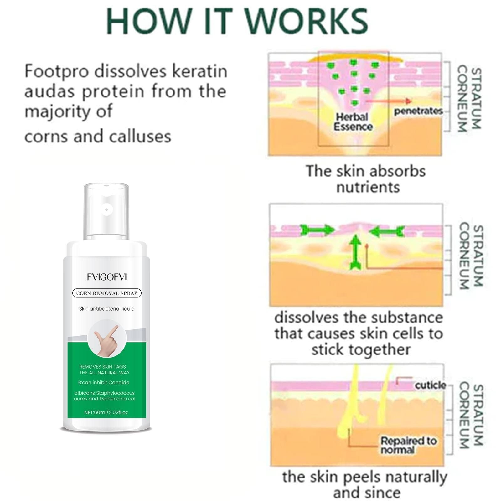 Corn Removal Spray 120ml Pack of 2 cs2856-ri