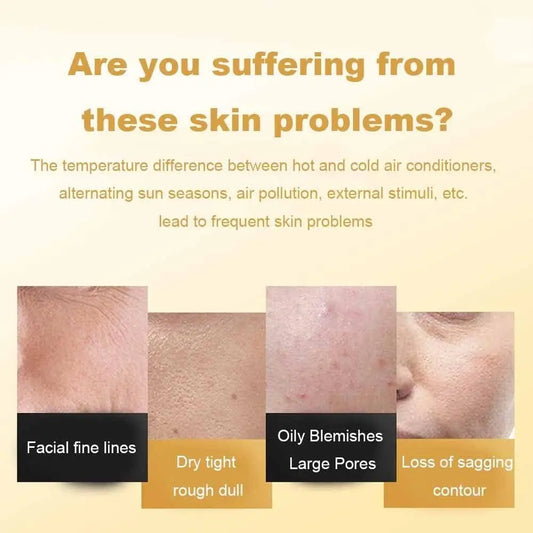 Gold Peel off Mask (Pack of 2) cs2856-ri