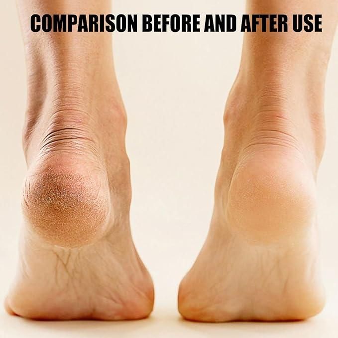 Electronic Pedicure Tool cs2856-ri