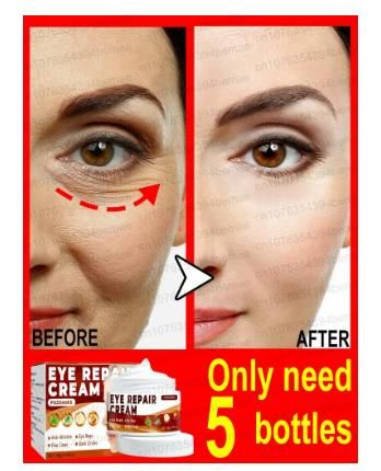 Eye Repair Cream (Pack of 2) cs2856-ri
