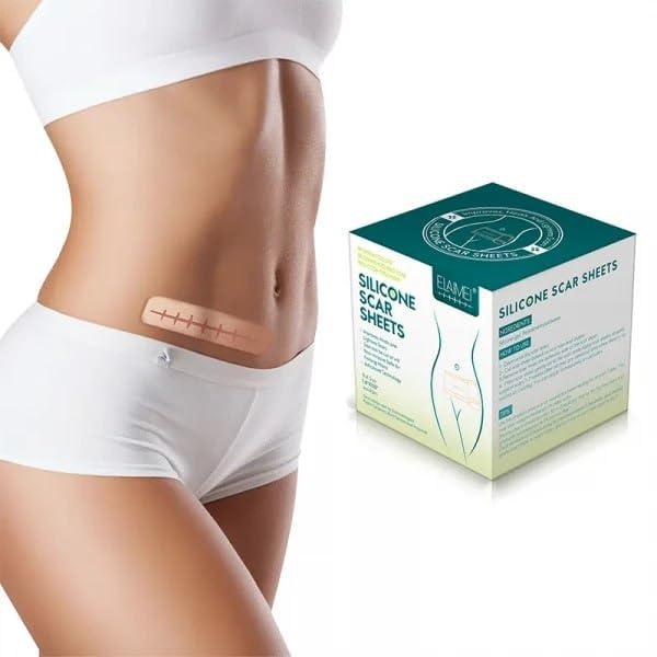 Silicone Scar Sheets