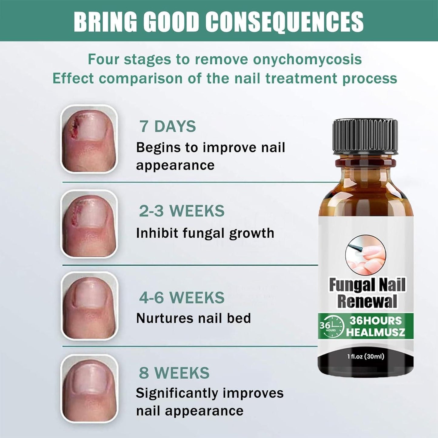 Fungal Nail Renewal