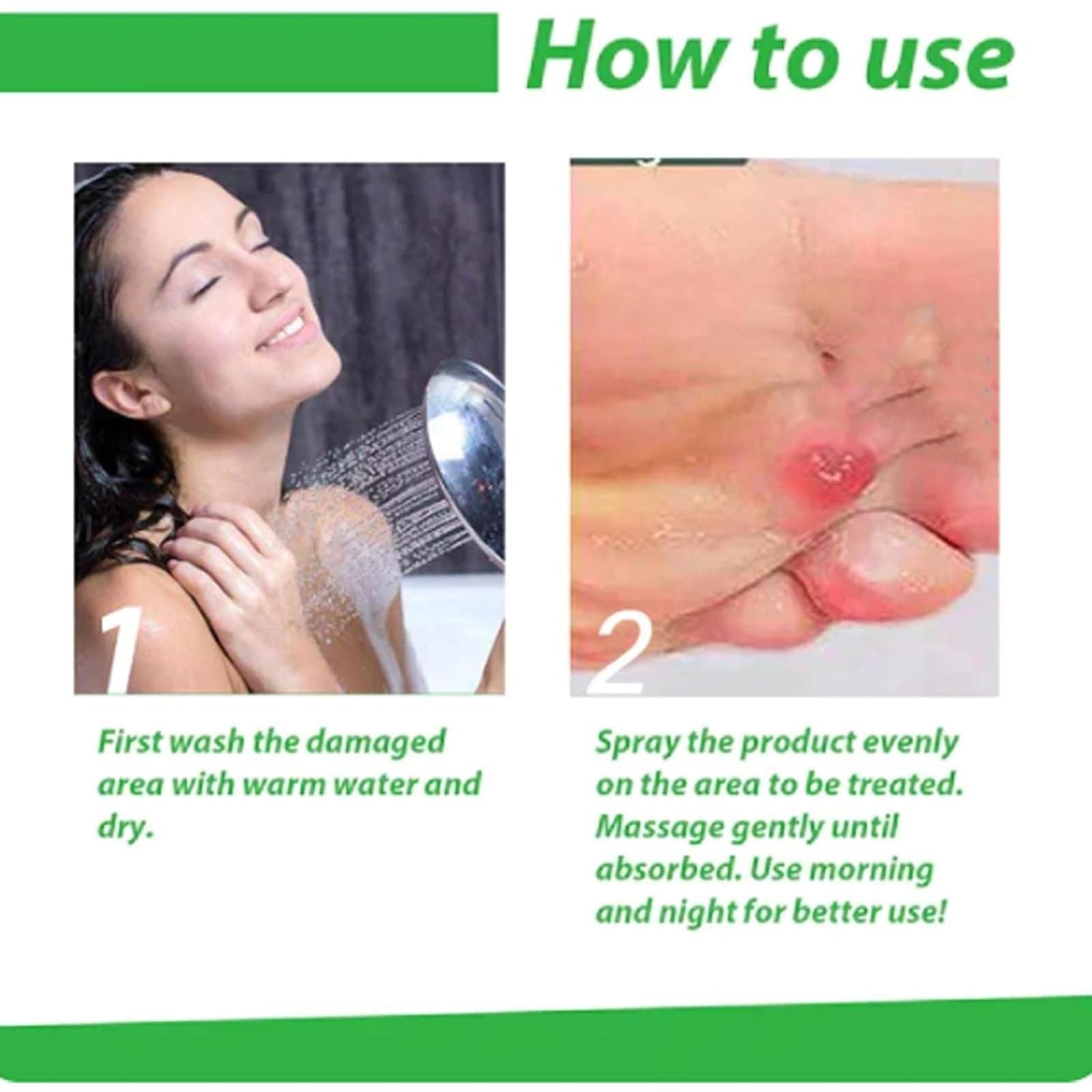 Corn Removal Spray 120ml Pack of 2 cs2856-ri