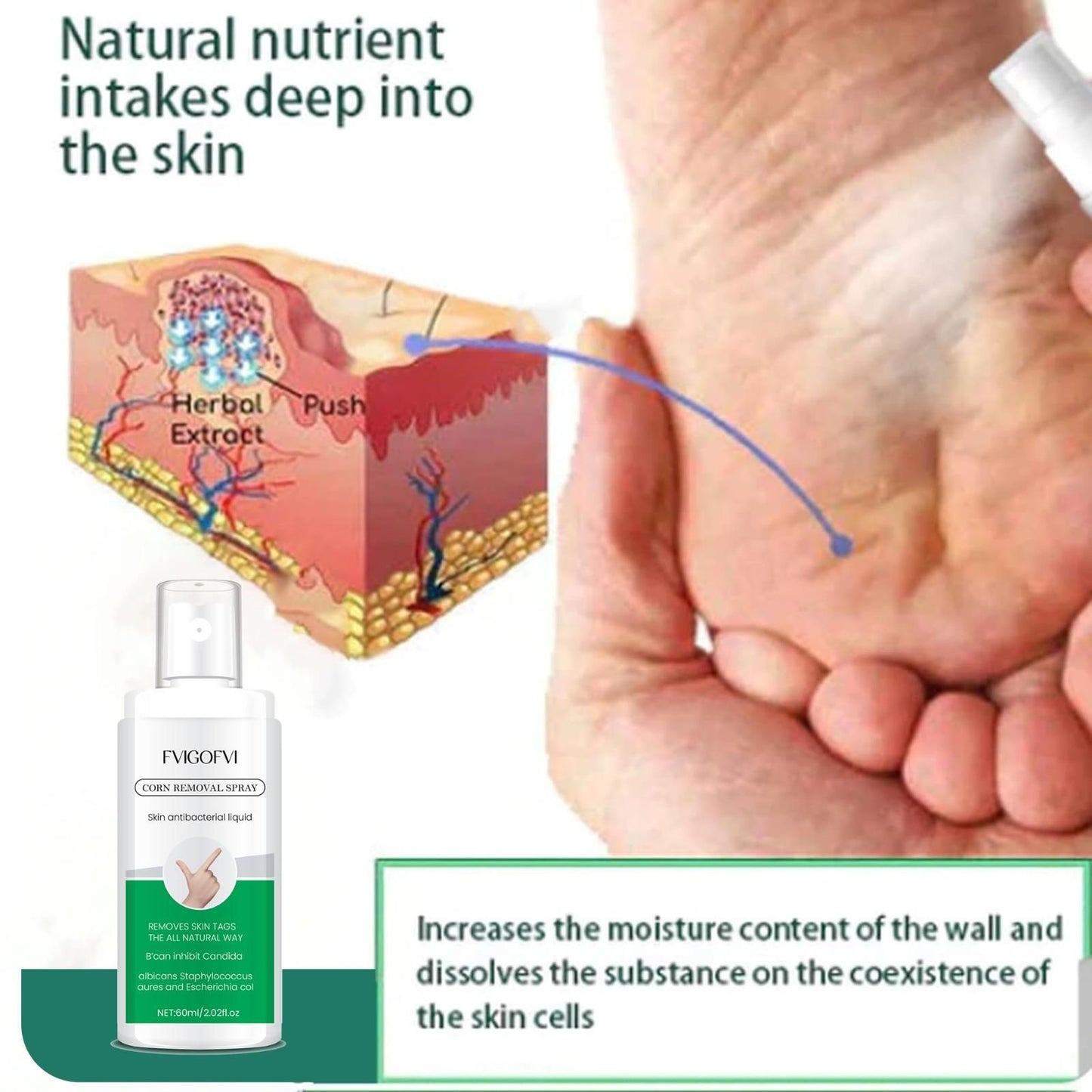 Corn Removal Spray 120ml Pack of 2 cs2856-ri